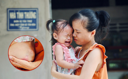 Mẹ bệnh không dám đi chữa trị, gom góp tiền cứu con gái 2 tuổi bị thận ứ nước, suy dinh dưỡng nặng