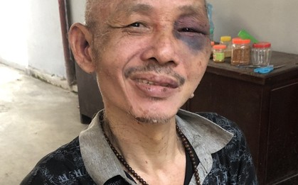 Bắt giữ đối tượng nghi ngáo đá, thường xuyên quậy phá hàng xóm