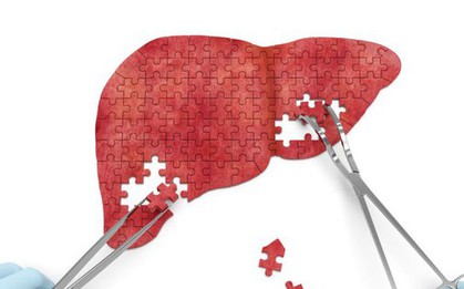 2 loại nước khiến gan tổn thương nhanh chóng, nhiều người "vô tư" dùng giải khát mùa hè