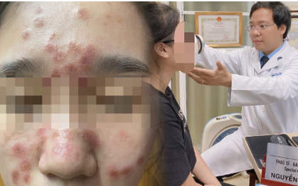 Chi tiền triệu để sở hữu làn da căng bóng, nhận lại khuôn mặt đầy nốt u cục