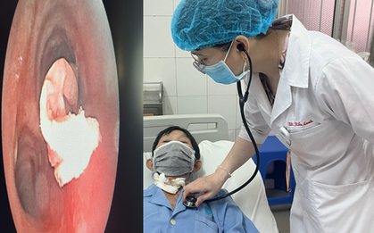 Nỗ lực lấy đoạn khăn giấy rớt vào phế quản bệnh nhân ung thư