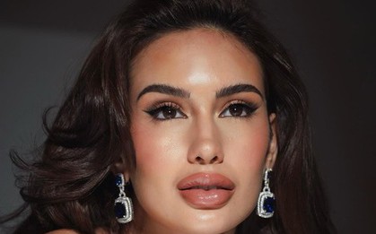 Hoa hậu Hoàn vũ Philippines bị chê gương mặt như thẩm mỹ hỏng