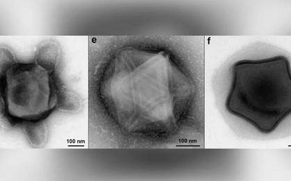 Phát hiện mầm bệnh kinh dị nhất: Virus có xúc tu bạch tuộc