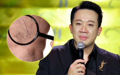 Căn bệnh khiến Trấn Thành vắng bóng truyền hình là bệnh gì, triệu chứng ra sao?