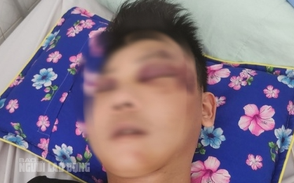 Tình hình sức khỏe thanh niên bị đá, đạp dã man vào đầu, bất tỉnh trên quốc lộ