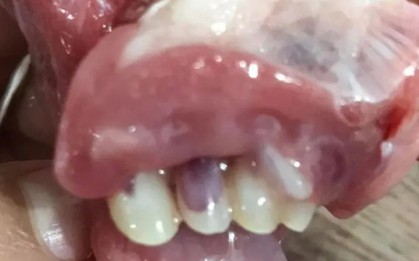 Người phụ nữ rụng rời vứt cả con cá khi thấy hàm răng giống hệt răng người