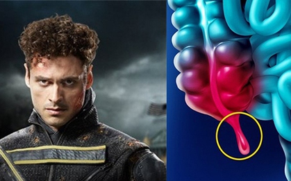 Sao phim "X-Men" qua đời ở tuổi 42 vì ung thư ruột thừa: Căn bệnh hiếm gặp, khó phát hiện và đang tăng nhanh