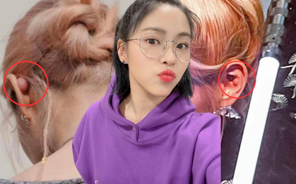 Idol Kpop gây sốc với nốt mụn nước cực lớn, sưng to ở lỗ tai, ai thích xỏ khuyên cần lưu ý
