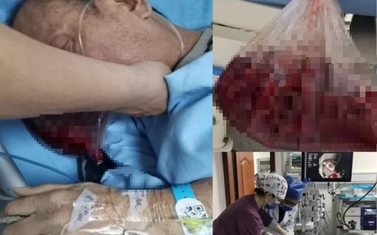 Người đàn ông nôn ra hơn 2 lít máu trong 5 phút vì dạ dày bị “tàn phá” bởi thói quen ăn uống