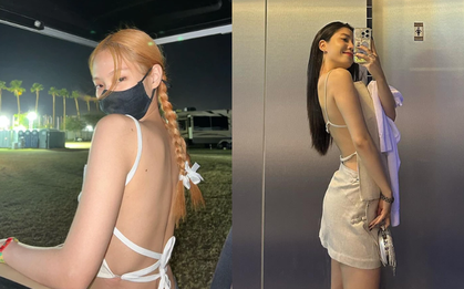 Cả Kbiz diện đồ hở lưng không sao, đến Hwayoung bị chê tới tấp