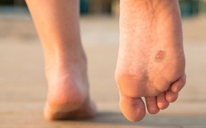 6 thay đổi trên chân ngỡ bình thường lại là dấu hiệu của ung thư ít người biết