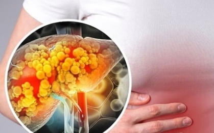 5 loại lá thảo dược là “khắc tinh” của gan nhiễm mỡ, ở Việt Nam cực nhiều