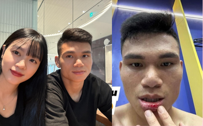 Hậu vệ từng "nghèo nhất Việt Nam" chảy máu môi khi thi đấu, vợ không thương lại nói lời "cay đắng" thế này đây
