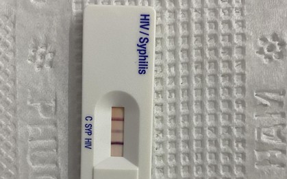 Nhiễm cùng lúc HIV và giang mai chỉ sau 1 lần "quan hệ" không nhớ có dùng "biện pháp bảo vệ" hay không