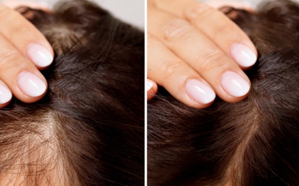 Không cần dùng thuốc, 7 thực phẩm này có thể kích thích mọc tóc, giảm gãy rụng