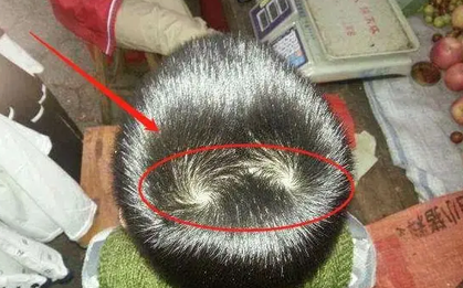 Thấy con có 2 xoáy tóc trên đầu, nhiều bố mẹ vui mừng tột độ: Sự thật đằng sau lại gây hụt hẫng