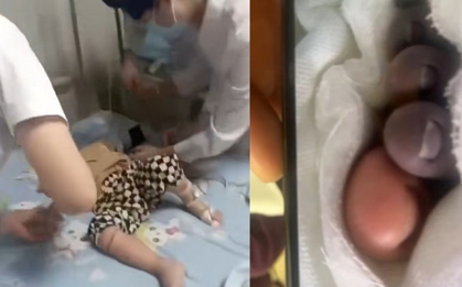 Bé trai 2 tuổi nhiễm vi khuẩn ăn thịt người, phải cắt cụt chi vì nghịch cá ở chợ