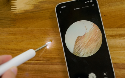 Dùng thử ngoáy tai gắn camera Xiaomi Bebird R1: Rẻ mà "ngon", dùng tiện, ngoáy sạch, kèm cả nhạc du dương