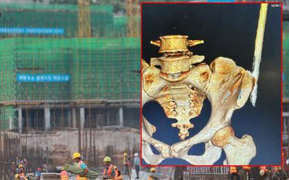 Thêm 1 vụ tai nạn lao động ở công trường xây dựng, nữ công nhân bị thanh sắt rơi trúng, đâm xuyên người