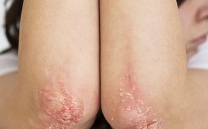 Lý do nhiều người nước ngoài chọn Việt Nam chữa bệnh, làm đẹp
