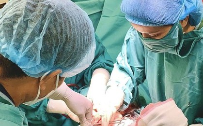 Hi hữu, 2 em bé chào đời cùng vòng tránh thai