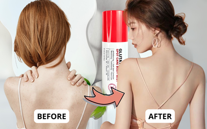 6 sản phẩm hô biến lưng đầy mụn thành láng mịn nuột nà, có món chất lượng mà giá chưa đến 200k