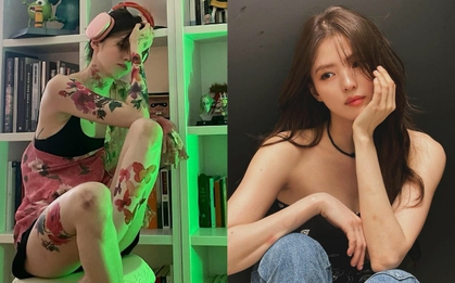 Loạt ảnh làm rộ tin Han So Hee bất ổn tâm lý hậu scandal, vết bầm tím khắp người