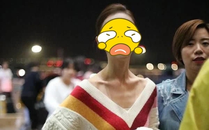 Mỹ nhân gầy trơ xương đáng báo động vì giảm cân cực đoan, lý do đằng sau khiến dân tình sốc nặng