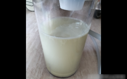 Hút ra 1000ml đờm từ phổi của người đàn ông, không hút "có thể chết đuối trong đờm của chính mình"?