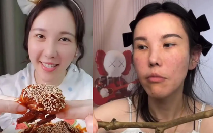 Mặt cô gái biến dạng nghiêm trọng sau 2 năm làm Mukbang