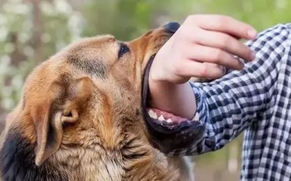 Người đàn ông tử vong sau 2 năm bị chó cắn