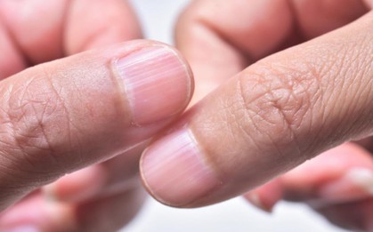Đàn ông có thận khoẻ sẽ không bị đen ở 3 bộ phận này