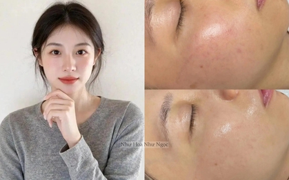 Tôi đã tìm ra cách "bơm" collagen cho da căng mướt, tới độ không ai ngờ tôi đã 35 tuổi