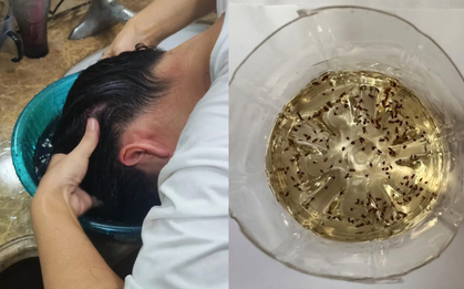 Lần đầu tiên sau 40 năm cuộc đời phát hiện: 9 sự "bá đạo" của giấm trắng