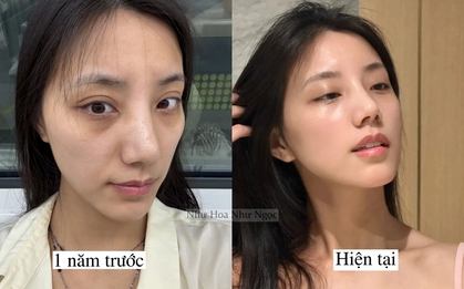 Tôi lấy lại làn da tuổi 20 nhờ 1 năm ngủ sớm, ăn lành và chăm da đúng cách