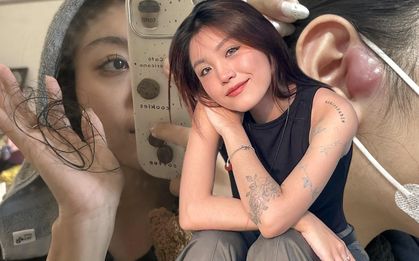 Cô gái TP.HCM 24 tuổi bị ung thư hạch giai đoạn 4: Bác sĩ nói lý do có thể đến từ... mọi thứ