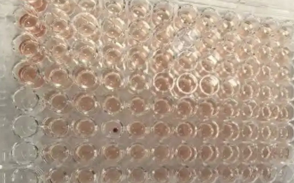 Phát hiện người mang máu kim cương