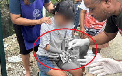 Nhờ lấy hộ cái túi không được, cha tấn công con gái dã man, lời kể của người trong cuộc gây khó hiểu