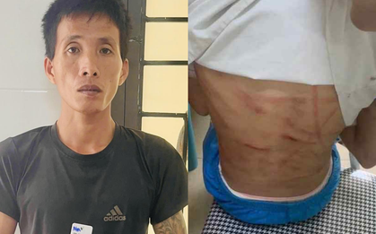 Lời khai của Nguyễn Văn Nam - gã cha dượng đánh đập bé gái lớp 5 dã man