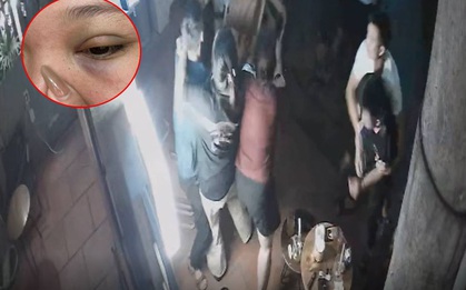 Hà Nội: Người phụ nữ tố bị thanh niên lạ mặt đánh gẫy xương hốc mắt, hé lộ nguồn cơn đầy bất bình