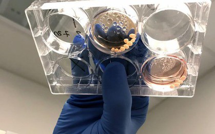 Lịch sử loài người thay đổi vì một chất độc