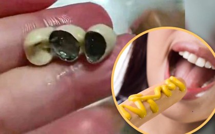 Hãi hùng: Phát hiện răng giả trong bánh, xúc xích, dimsum - Dư luận Trung Quốc dậy sóng