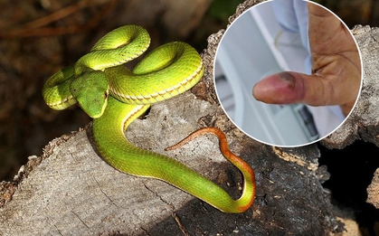 Vừa đưa tay lấy bàn chải, người đàn ông ở TP.HCM bị rắn lục đuôi đỏ tấn công ngay trong nhà vệ sinh