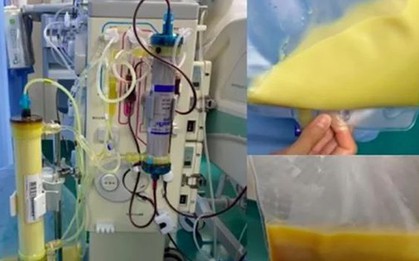 Người phụ nữ 27 tuổi "máu trắng đục" vì thường xuyên uống thứ nước vạn người mê