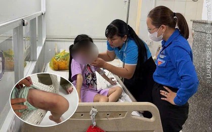 Mẹ ruột và người tình 19 tuổi thay nhau bạo hành dã man con gái 9 tuổi