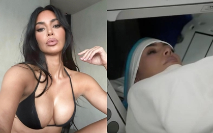 “Kim siêu vòng 3” bị phình mạch máu não