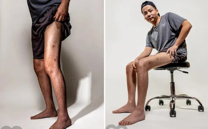 Tình trạng bất ổn của Khoa Pug