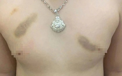 Phụ huynh tố giáo viên mầm non bạo hành trẻ, yêu cầu bồi thường 1 năm học phí?