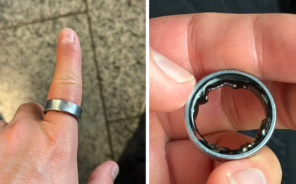 Người dùng hốt hoảng khi một sản phẩm của Samsung phồng pin, kẹt luôn trên ngón tay: "Vừa đau vừa sợ nổ"