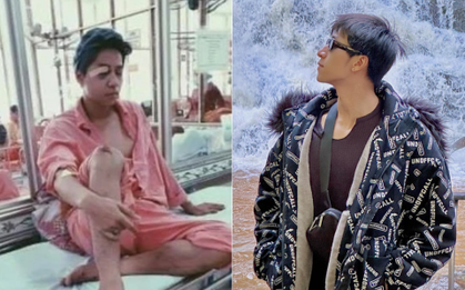 Anh Trai Say Hi bị tai nạn liệt nửa mặt, ám ảnh vì ngoại hình biến dạng